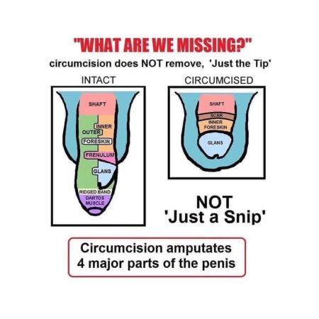 Does circumcision increase size. Things To Know About Does circumcision increase size. 